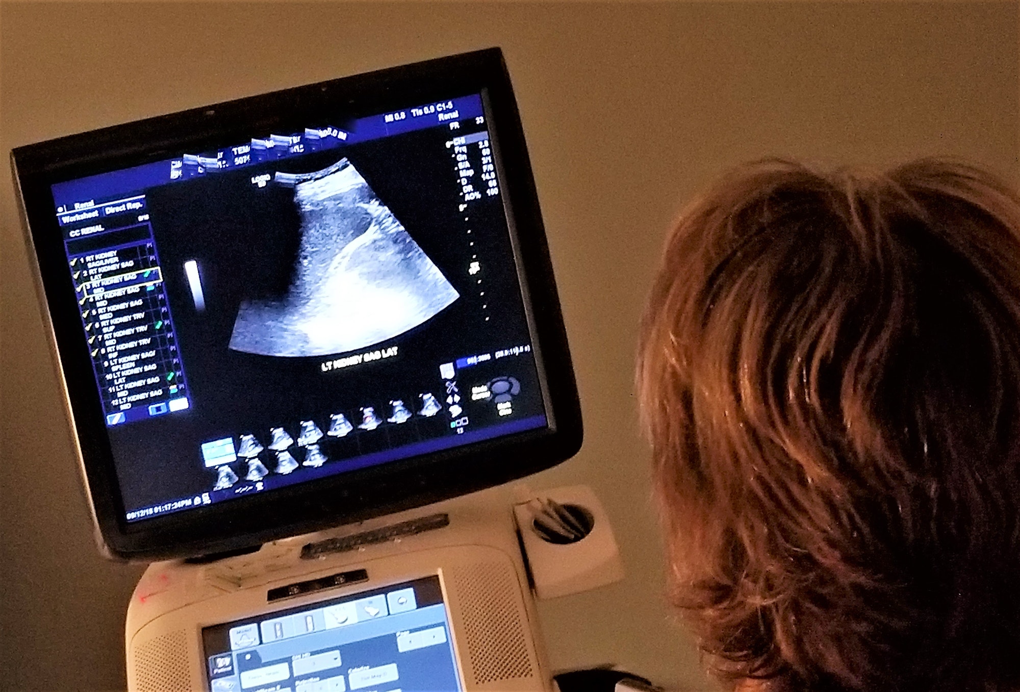 Kidney Ultrasound! Healthcare and Medicine!